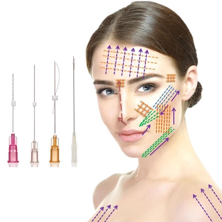 Botox